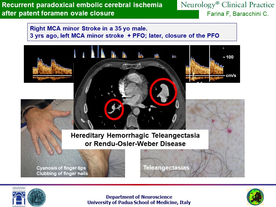 Quindicesima slide