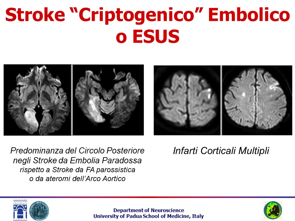 Ventesima slide