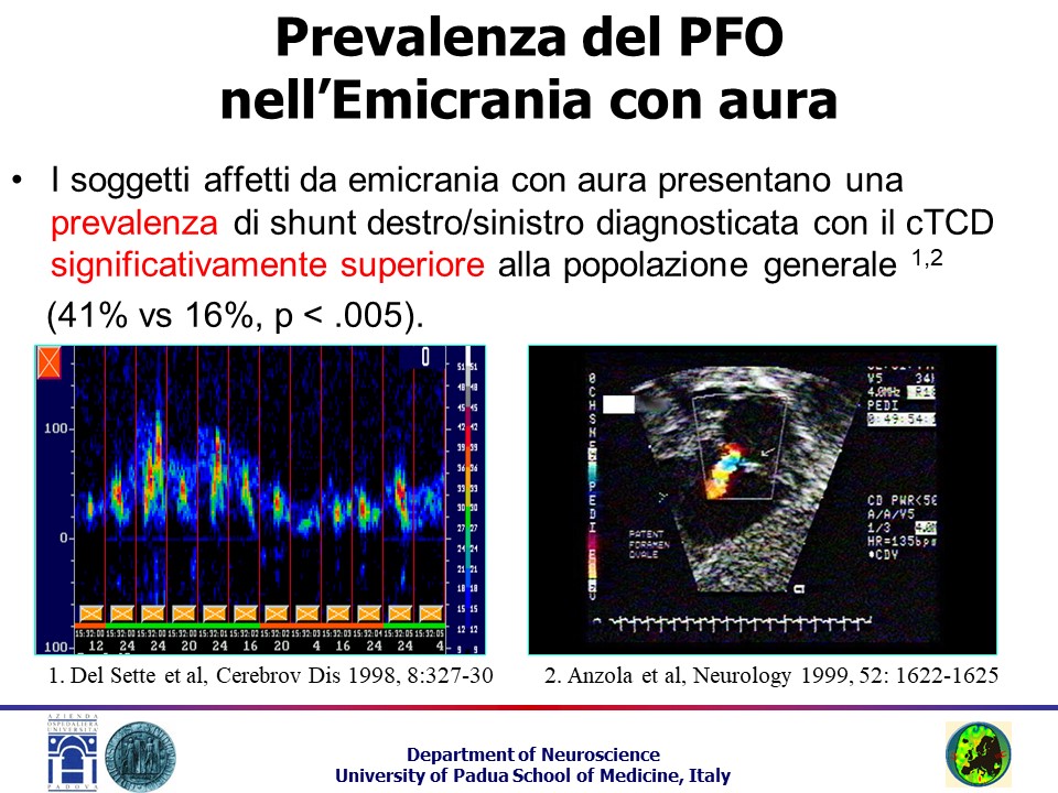 Terza slide